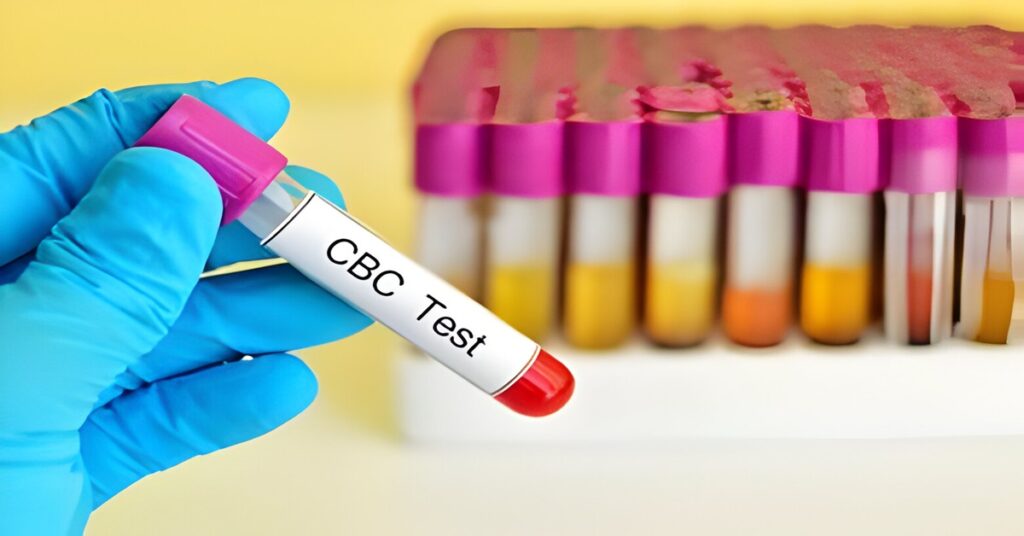 cbc test
